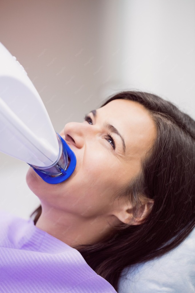 Bleaching-Behandlung mit Lichtaktivierung